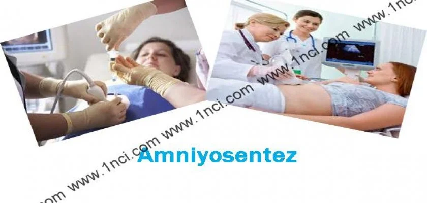 Amniyosentez