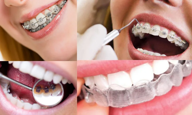 Ortodontik Tedavi Seçenekleri