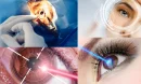 Göz Çizdirme Ameliyatı ve Göz Sağlığı Arasındaki Bağlantı Nedir?