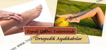 Topuk Dikeni Tedavisinde Ortopedik Ayakkabılar